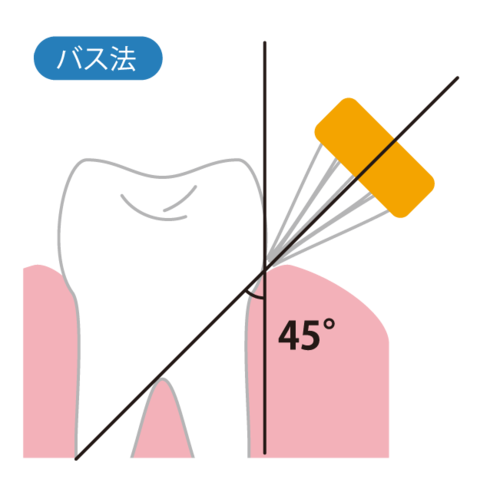 periodontitis-not-cured.png