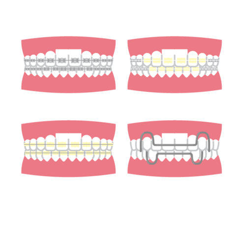 cavity-cause1.png