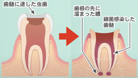 dental-treatment-stop1.png