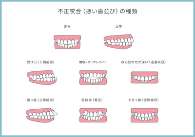 orthodontics-mouthpiece3.jpg