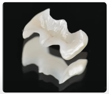 silver-teeth-ceramic3.png