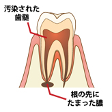 ステップ1