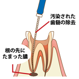 ステップ2