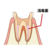 ステップ3