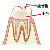 ステップ5